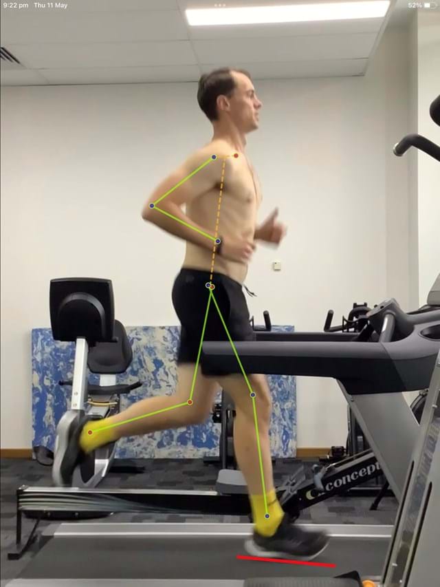 Running Analysis with a Running Expert I Perth I Mount Lawley I Northbridge